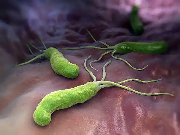 How Your Gut Bacteria Shape Digestive Health