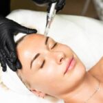 Micro needling